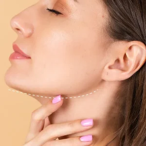 Relleno o contorno mandibular (3 ml)