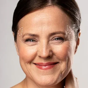 Relleno de zona temporal