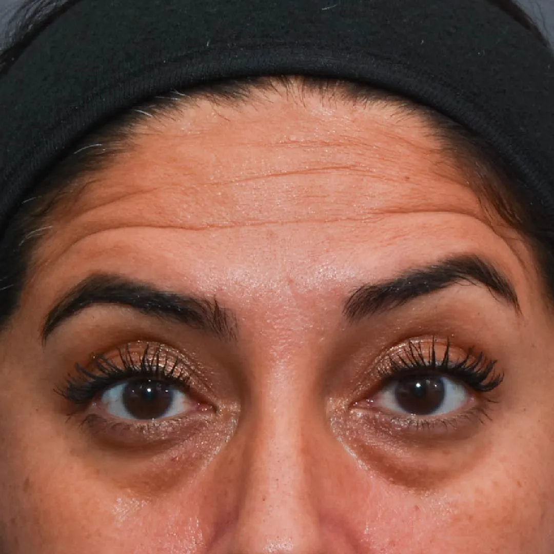 botox-casos-13_11zon botox-casos-13_11zon