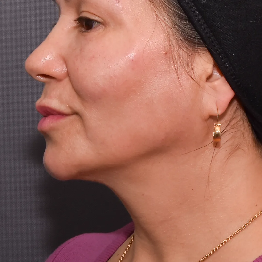 perfiladomandibular-20_11zon perfiladomandibular-20_11zon