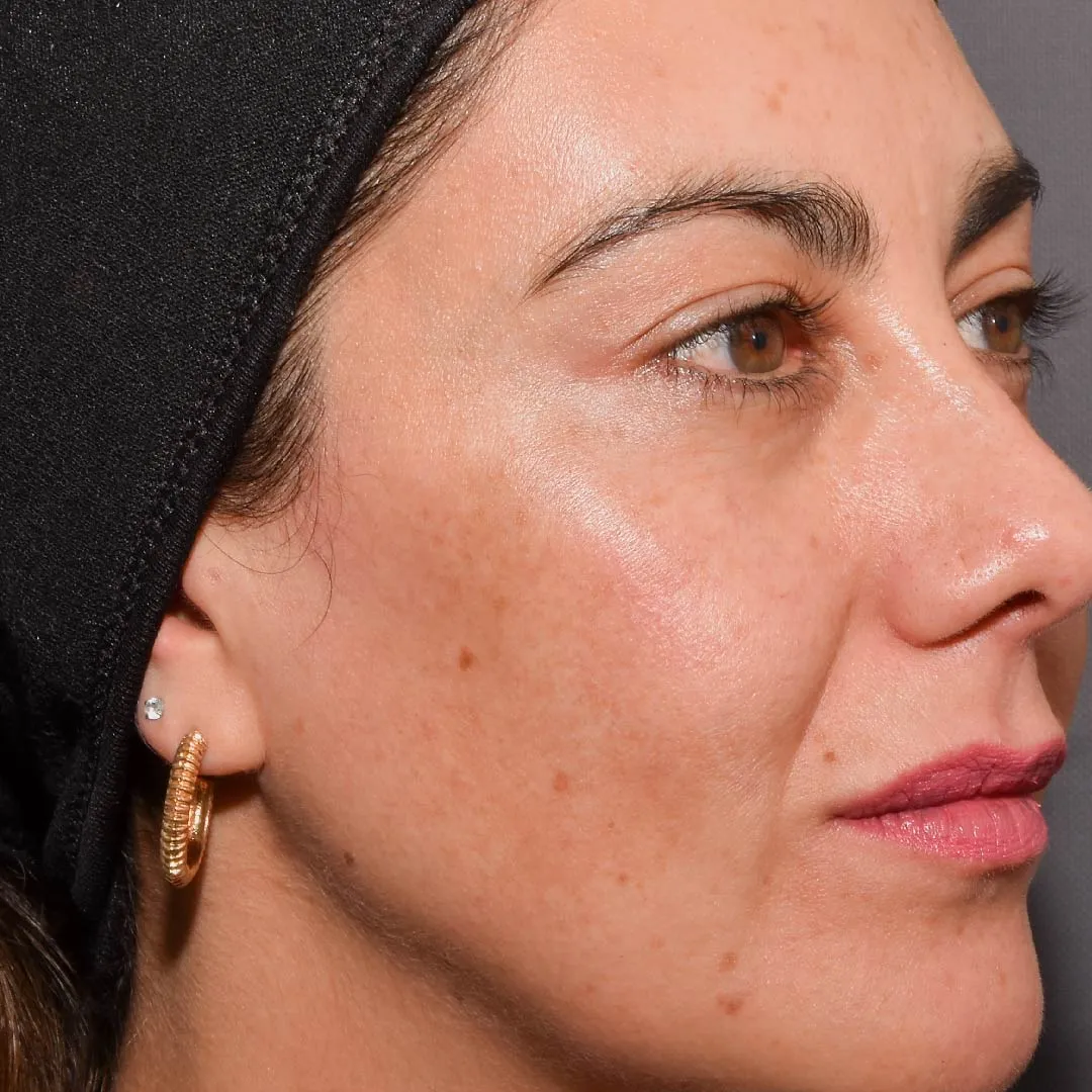 pomulox-19_11zon pomulox-19_11zon