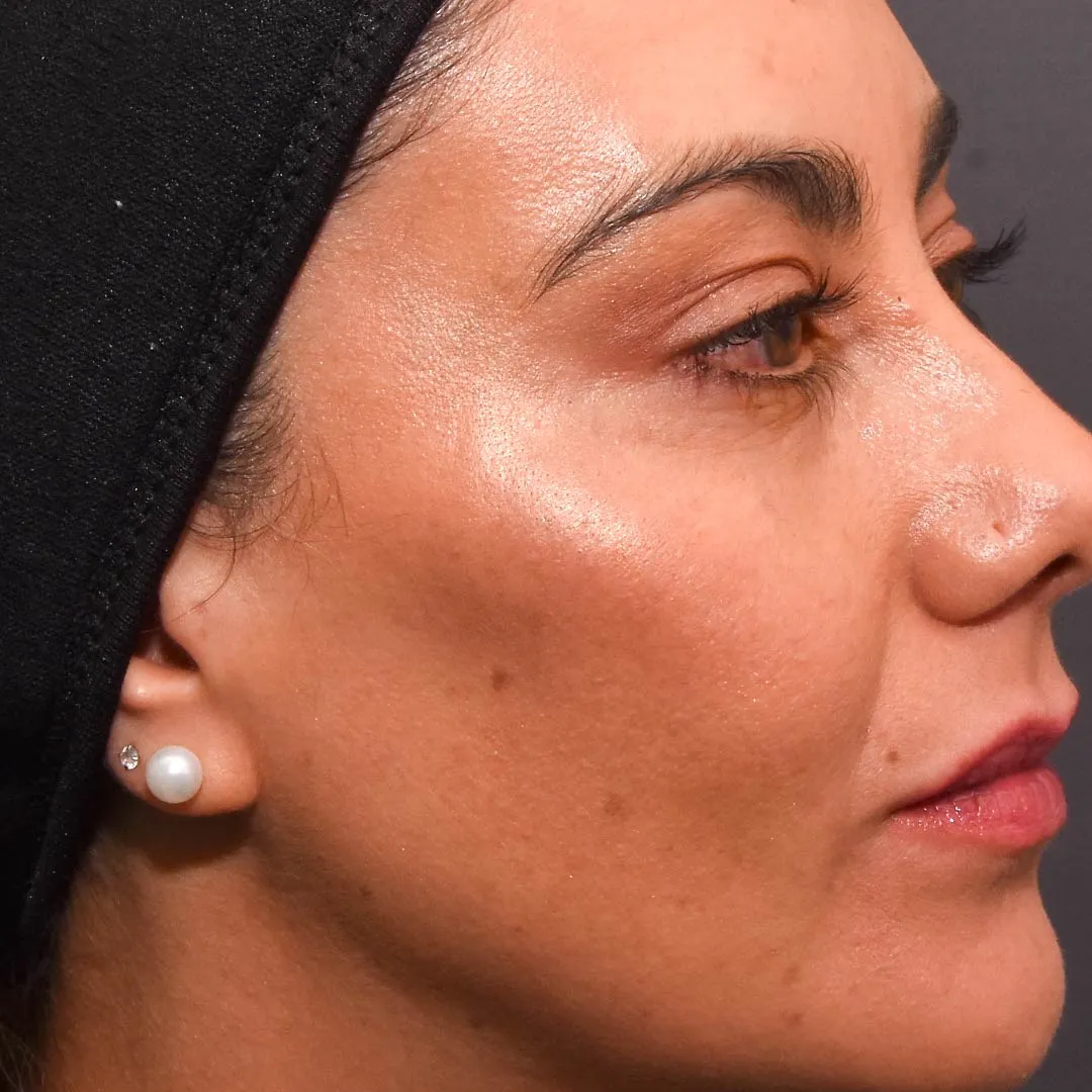 pomulox-20_11zon pomulox-20_11zon