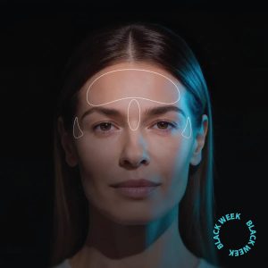 Bótox - Tercio superior